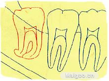 14岁少女宫外孕大出血 家长拒绝手术:英亚官方网站(图1) 英亚官网